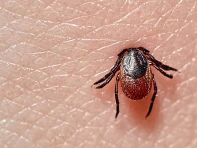 Malattia di Lyme: le cause e i sintomi della patologia