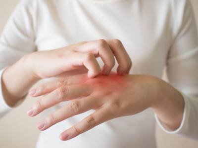 Hai un’improvvisa dermatite? Potrebbe essere lo stress: ecco come combatterla!