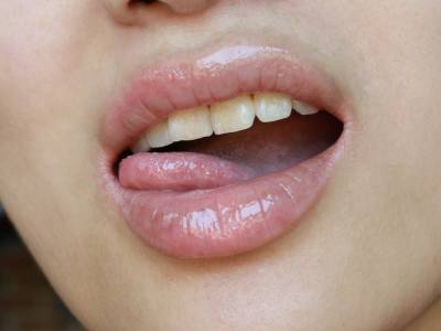 Bolle sulla lingua: cause e rimedi per sbarazzarsene