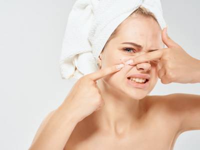 Grani di miglio sul viso: come prevenirli ed eliminarli