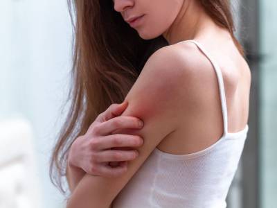 Che cos’è la dermatite atopica (e quali sono i rimedi per combatterla)