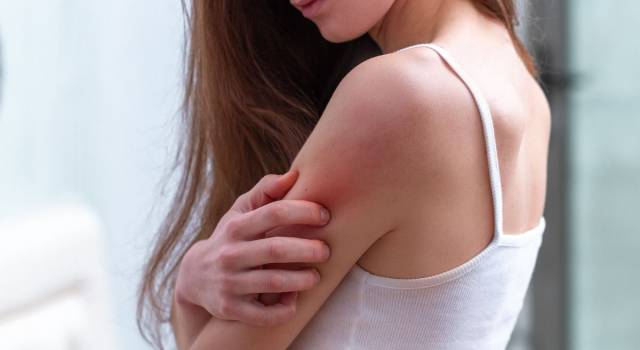 Che cos’è la dermatite atopica (e quali sono i rimedi per combatterla)