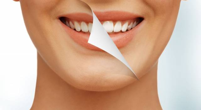 Denti macchiati: la colpa non è solo degli alimenti
