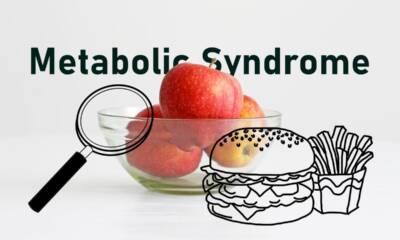 sindrome metabolica