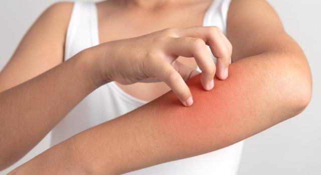 Malattie della pelle: quali sono e come si curano
