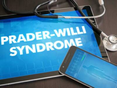 Sindrome di Prader Willi: di cosa si tratta e come riconoscerla