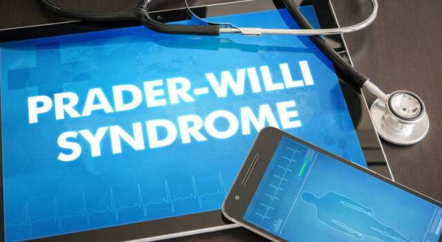 Sindrome di Prader Willi: di cosa si tratta e come riconoscerla