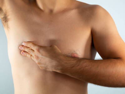 Tumore al seno maschile: come si riconosce e quali sono le cure