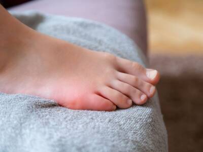 Frattura al mignolo del piede: sintomi e possibili cure