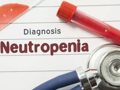Neutropenia: di cosa si tratta e quali sono i sintomi