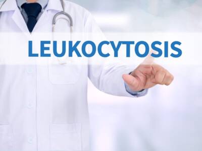 Leucocitosi: cause, sintomi e possibili cure