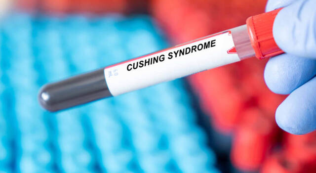 Sindrome di Cushing: sintomi e possibili cure