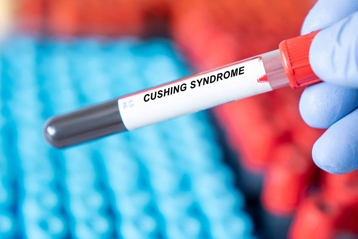 cushing's syndrome
