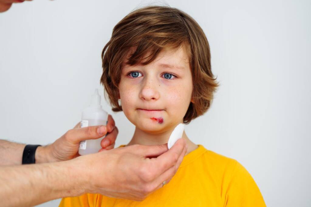 bambino graffio mento caduta disinfettare