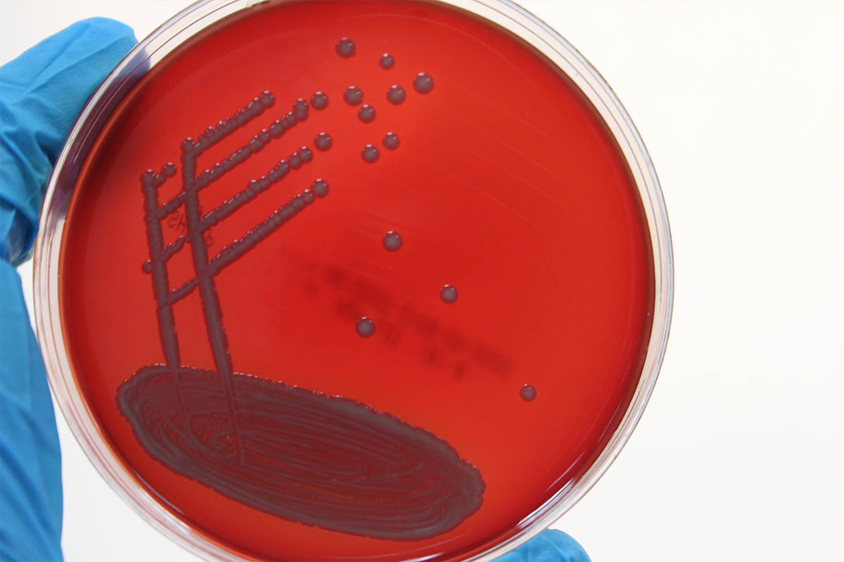 Klebsiella pneumoniae 10 5. Стафилококк клебсиелла. Клебсиелла чувствительность. Бактериологическое исследование клебсиеллы.