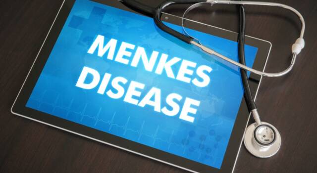 Malattia di Menkes: sintomi e terapie possibili