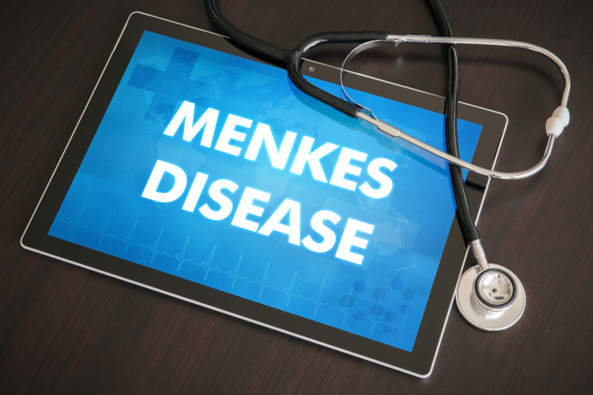 menkes disease