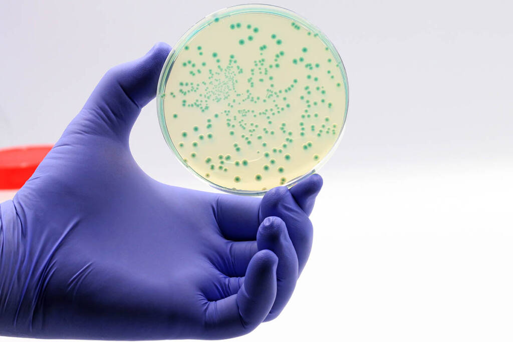 escherichia coli