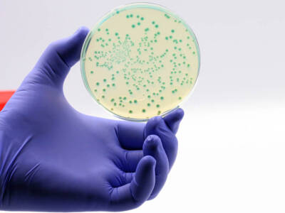 Escherichia coli: cos’è, come si contrae e quali sono le cure