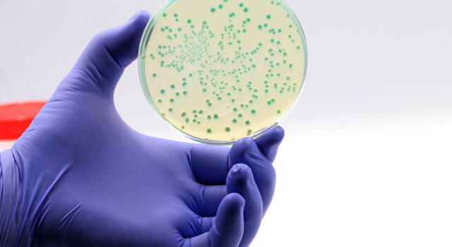Escherichia coli: cos&#8217;è, come si contrae e quali sono le cure