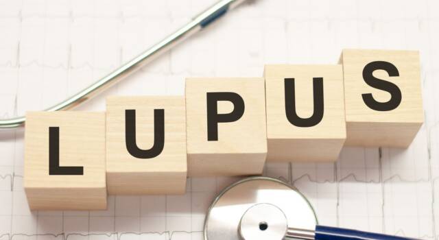 Lupus, cause e sintomi: lo stile di vita è fondamentale