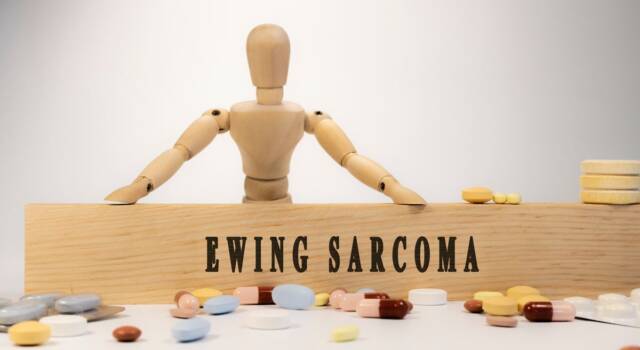 Il sarcoma di Ewing è raro: grazie alla ricerca però, si sopravvive nel 70% dei caso