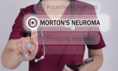 neuroma di morton