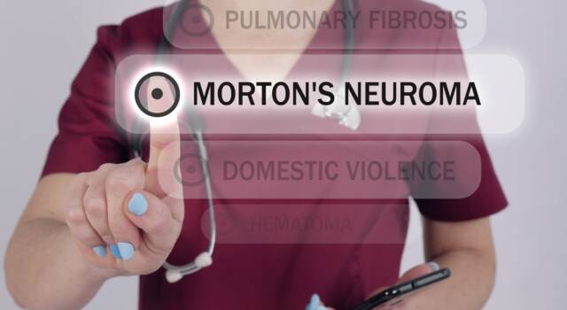 Neuroma di Morton: tutto sulla malattia che ha colpito la Regina Letizia di Spagna