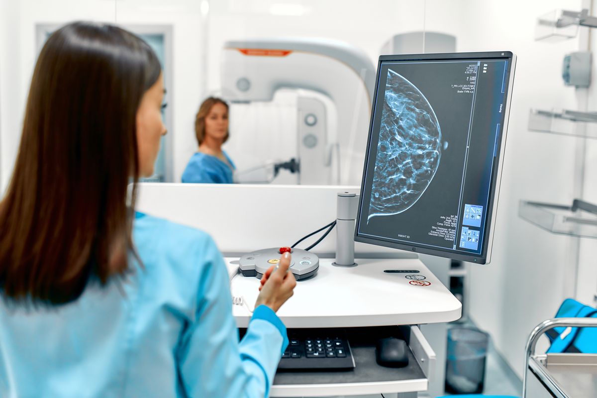 mammography screening test