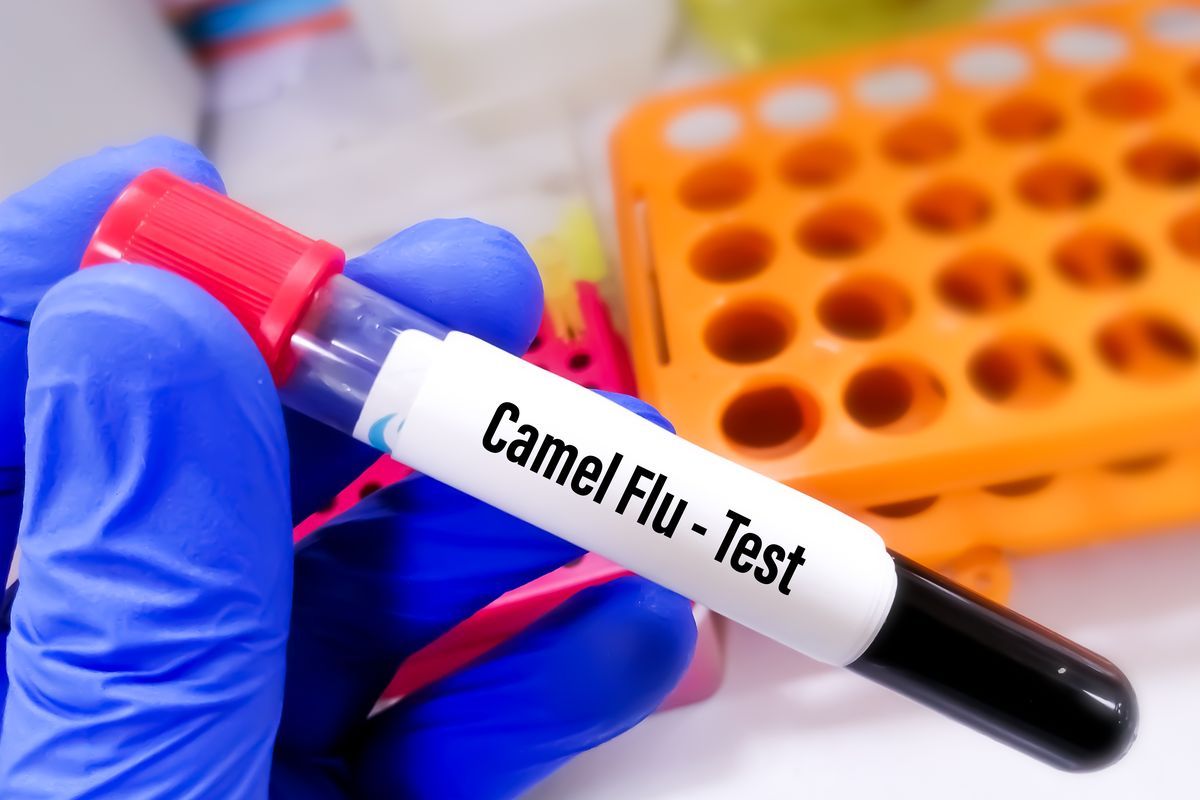 camel flu test