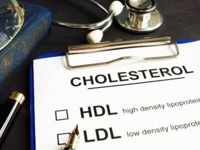 Vitamina k2 e colesterolo, è fondamentale per combattere l’LDL: ecco dove trovarla