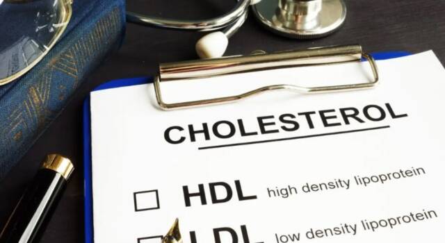 Vitamina k2 e colesterolo, è fondamentale per combattere l&#8217;LDL: ecco dove trovarla
