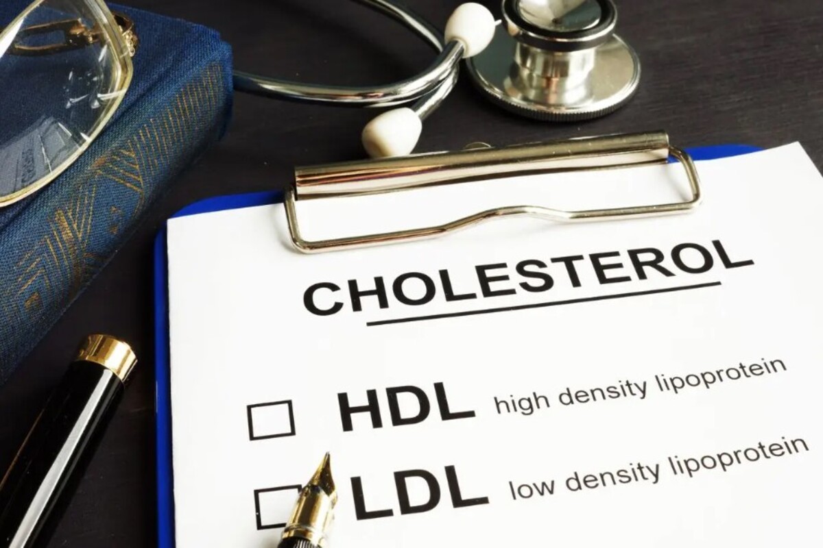 cholesterol tests