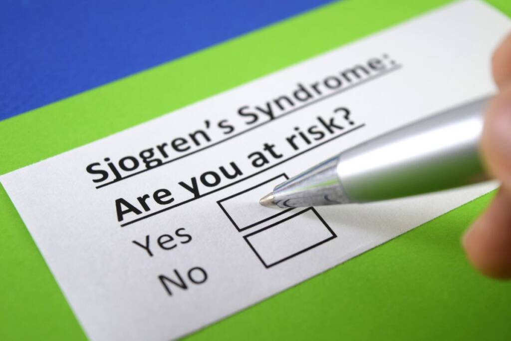 sindrome di sjogren