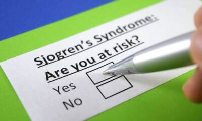 sindrome di sjogren