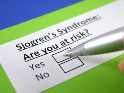 Sindrome di Sjögren: di cosa si tratta e come convivere con questa malattia