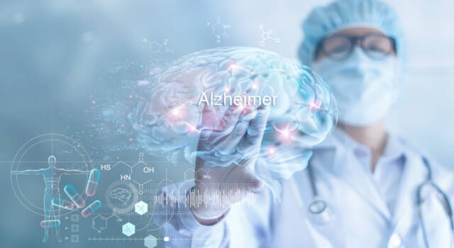 Morbo di Alzheimer: cos&#8217;è, sintomi e cause