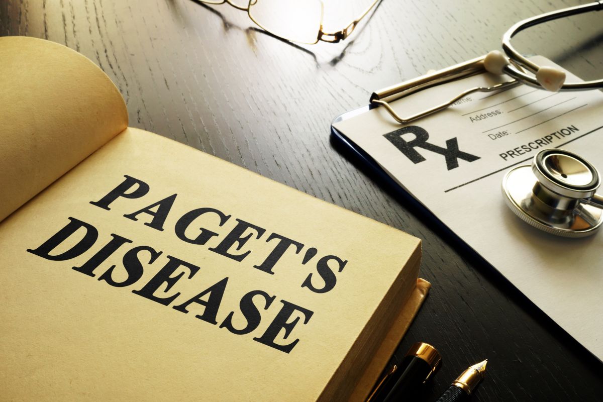 Paget's disease