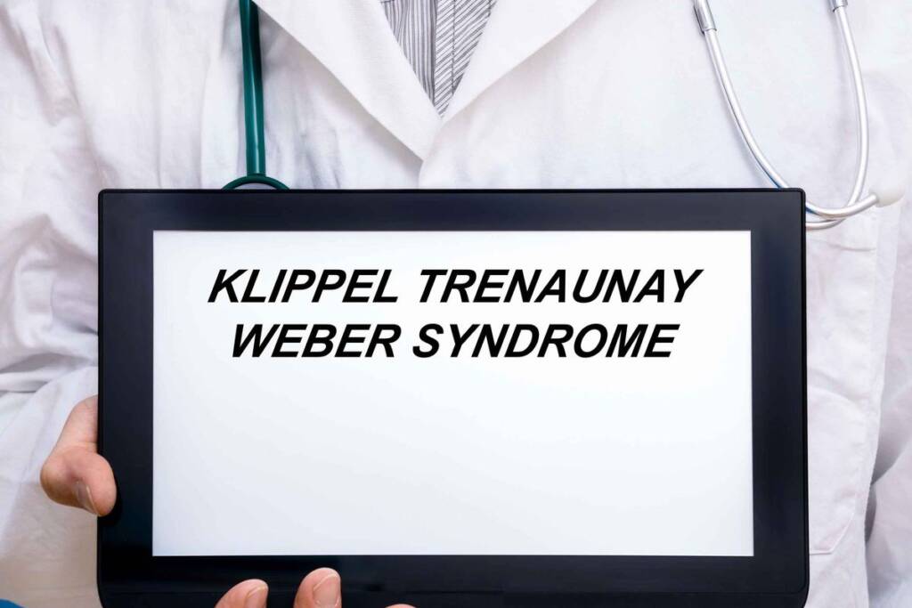 sindrome klippel trenaunay weber