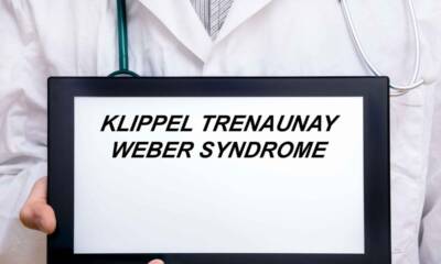 sindrome klippel trenaunay weber