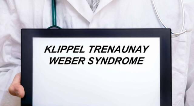 Sindrome di Klippel Trenanunay Weber: sintomi, cause e possibili cure