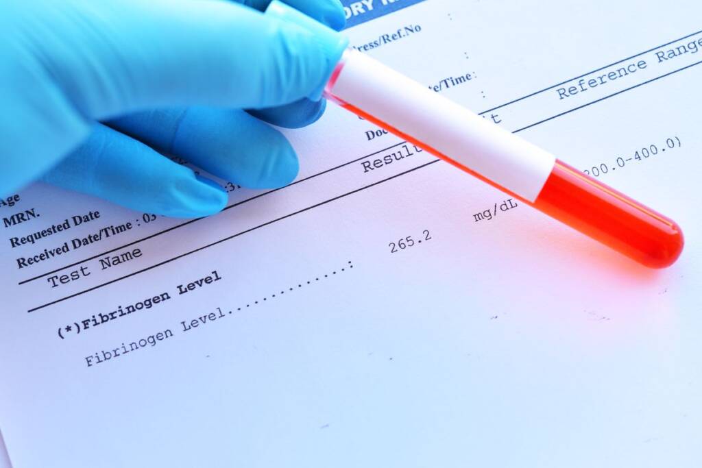 fibrinogen test