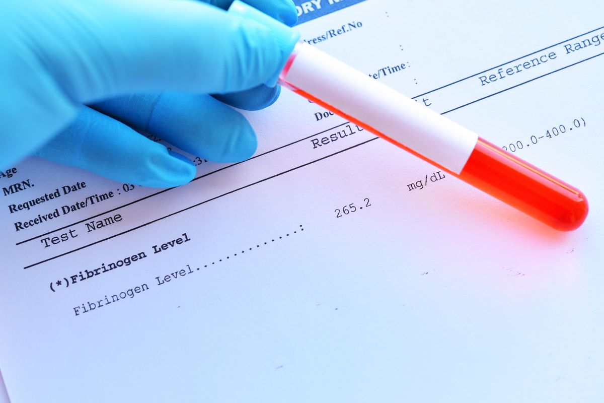 fibrinogen test