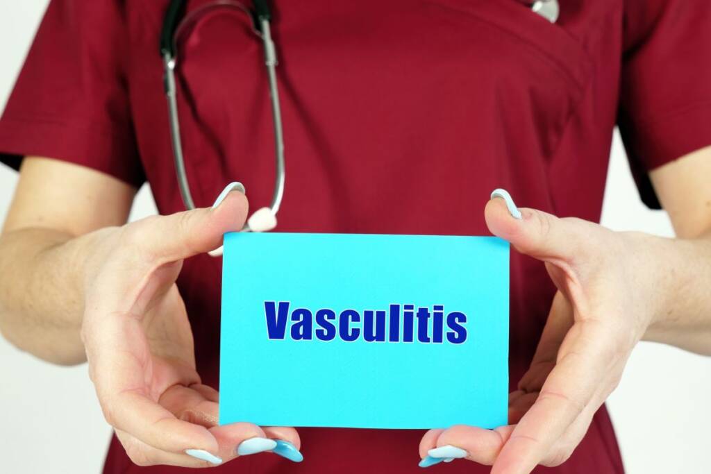 vasculite