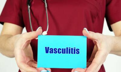 vasculite