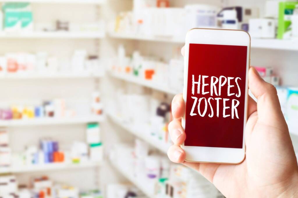 herpes zoster