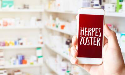 herpes zoster