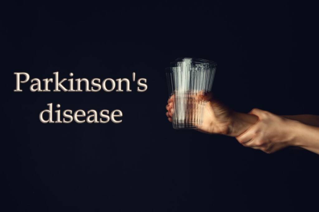 morbo di Parkinson