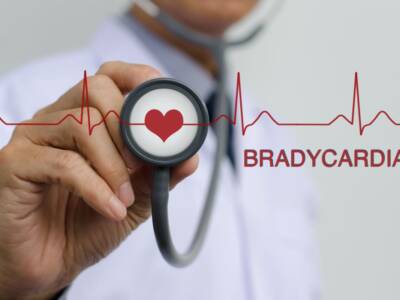 Bradicardia: cos’è, sintomi e cure