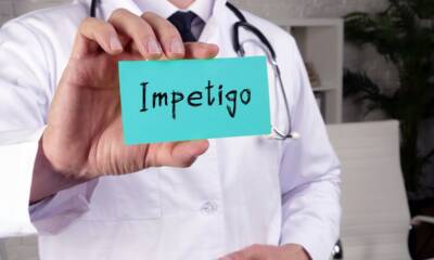 impetigine